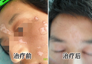 ��ͬѧ 21�� �沿����