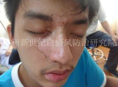 ��ͬѧ  18��  �沿����