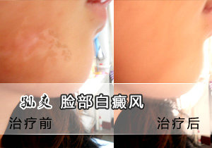 ��С�� 24�� �°Ͳ�����