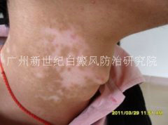 ������ 25�� ��������