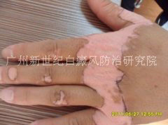 ������ 36�� �ֲ�����