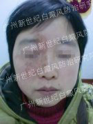 ��Ůʿ 34�� �沿����