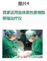 首家运用自体黑色素细胞移植治疗仪