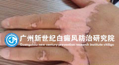 ������ 36�� �ֲ�����