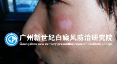 ��ͬѧ 22�� �沿����