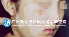 ��Ůʿ 34�� �沿����