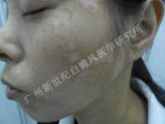 ����ɢ���԰װ�