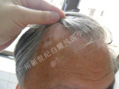 ͷ����������װߣ���