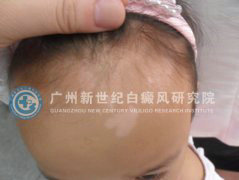 ͷ��С����װ�