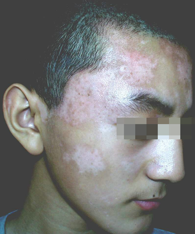 ���紫Ⱦ��