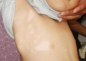 °×ñ°·ç×¢ÒâÊÂÏî