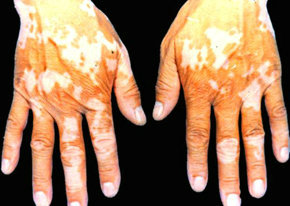 ��������֢״