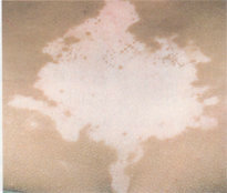 ��μ��ٰ��縴����