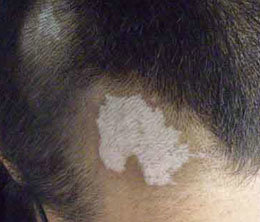 °×ñ°·ç²¡·¢¼²²¡