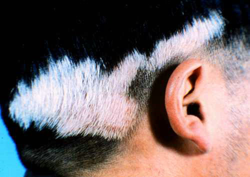 ͷ�����综��