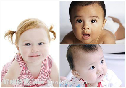 物理因素会诱发白癜风?