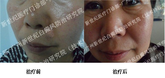 ���ưװ�Ҫ����Ǯ