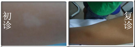 �������С���װ�?