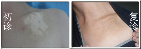 �����������Ʋź�