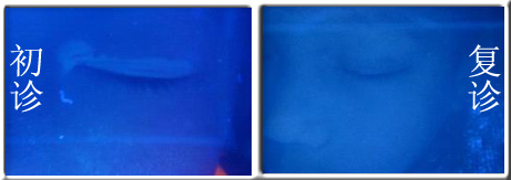 �����аװ��ܲ���ҽ��