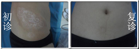 ���ư���Ҫ��òŻ���Ч��